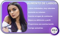 Aumento de labios precio Madrid Aumento de labios precio Madrid