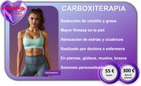 Carboxiterapia Carboxiterapia