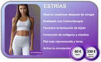 Tratamiento estrias carboxiterapia Tratamiento estrias carboxiterapia