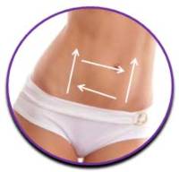 HILOS TENSORES ABDOMEN