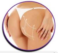 HILOS TENSORES GLUTEOS HILOS TENSORES GLUTEOS