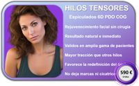 Hilos tensores