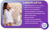 Labioplastia