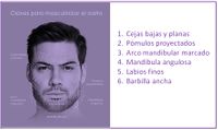 Masculinización facial