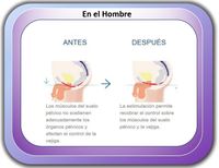 Resultados Antes y después del tratamiento Emsella Resultados Antes y después del tratamiento Emsella